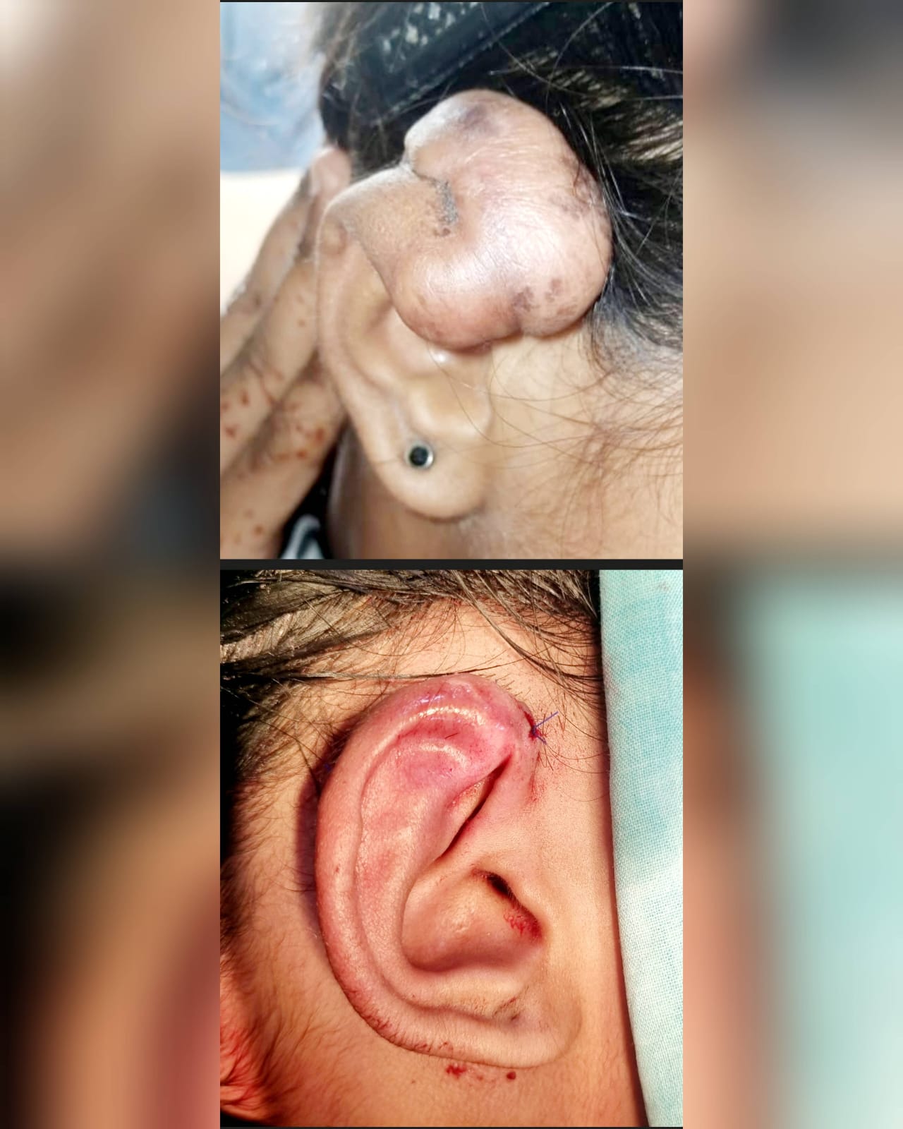 Before & After 56